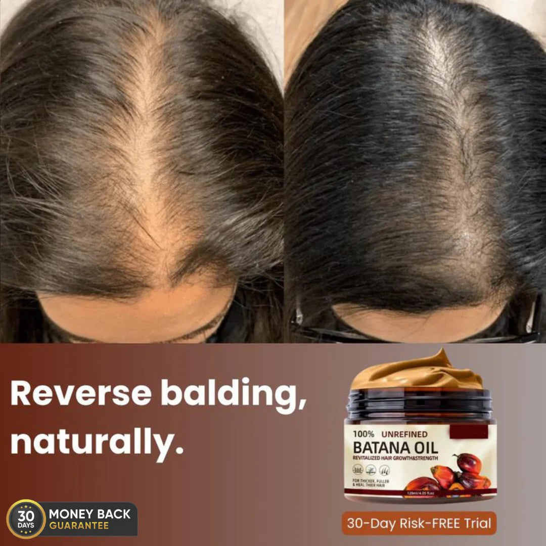 FORTIVUS™  - 100% UNREFINED BATANA OIL (Buy 1 Get 1 Free)