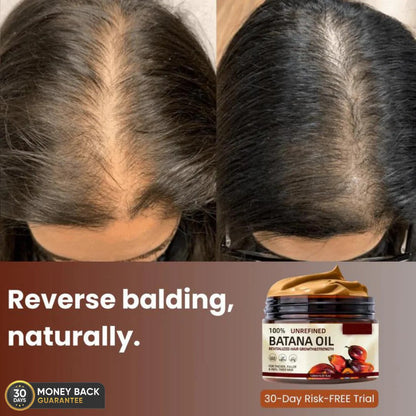 FORTIVUS™  - 100% UNREFINED BATANA OIL (Buy 1 Get 1 Free)